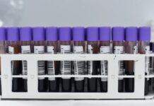 Сила стратегічної філантропії: максимізація впливу завдяки пожертвам