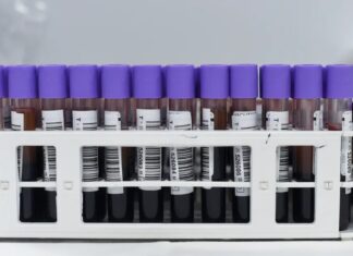 O poder das doações estratégicas: maximizando o impacto com doações de caridade
