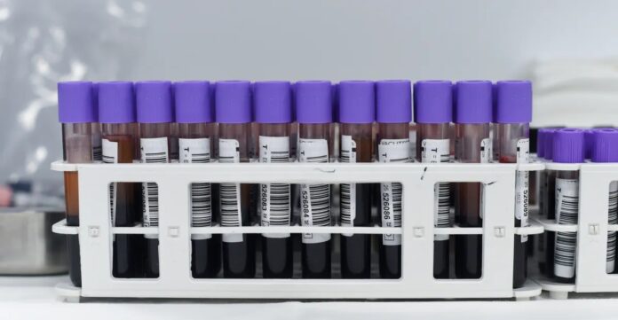 70a90211-da7b-4479-9987-5d66023ab021